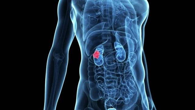 Havalar ısındı böbrek taşına dikkat! Uzman isim uyardı - Resim: 14